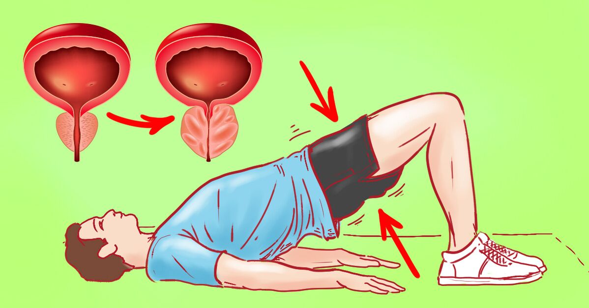 Mga pagsasanay sa therapeutic para sa talamak na prostatitis