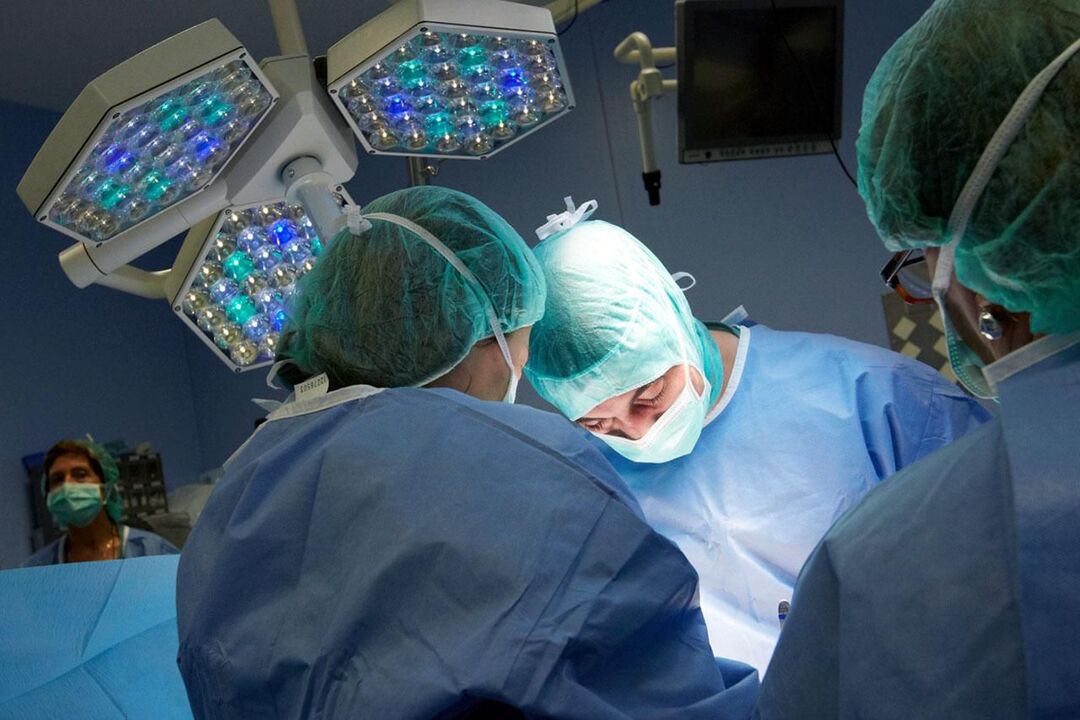 Operasyon sa talamak na prostatitis