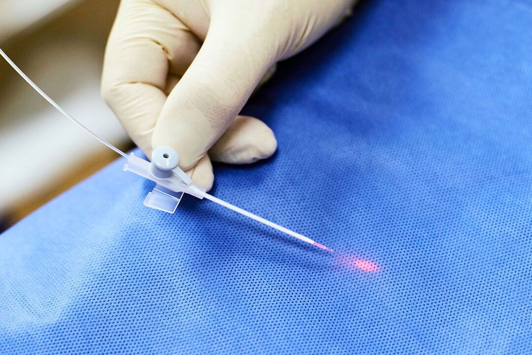 transrectal na aparato para sa paggamot sa prostate